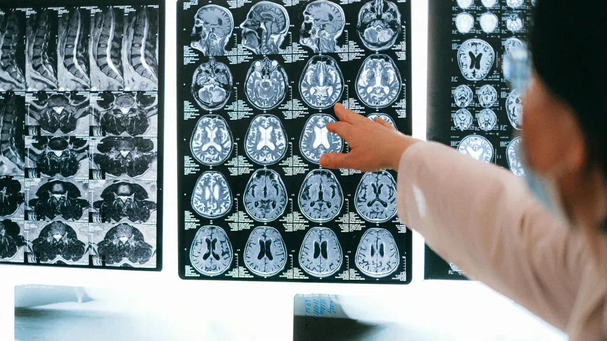 Estresse na pandemia pode ter envelhecido nossos cérebros, diz estudo